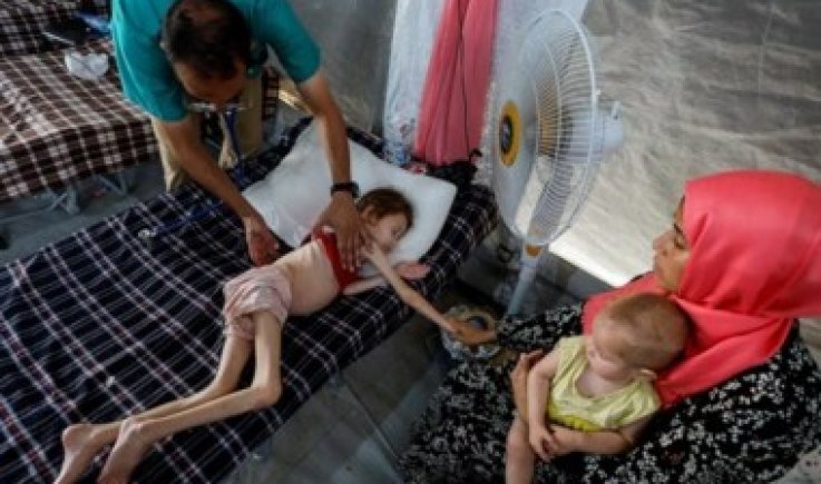 "صحة غزة": وفاة 18 حالة خلال 24 ساعة بسبب المجاعة في مجزرة صامتة